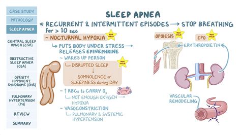 obstructive sleep apnea hypertension